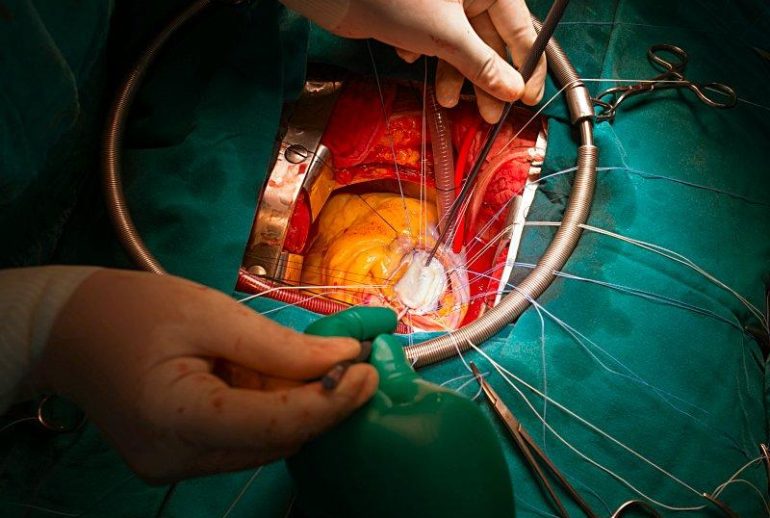 1717966775.046738_849654_image