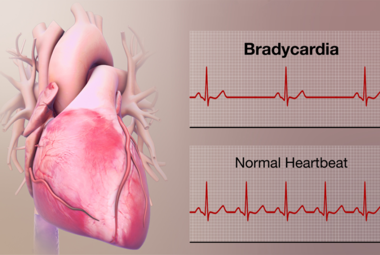 1717967029.559506_967821_image